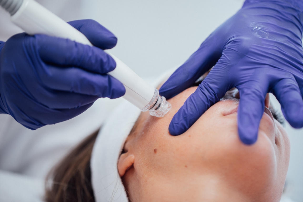 ONA Hydrofacial behandeling